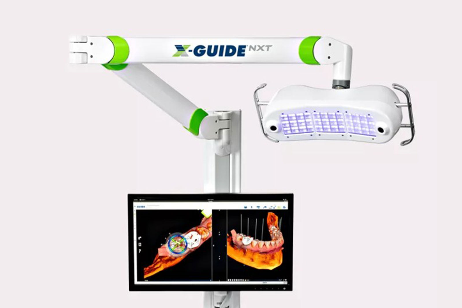 X-Guide